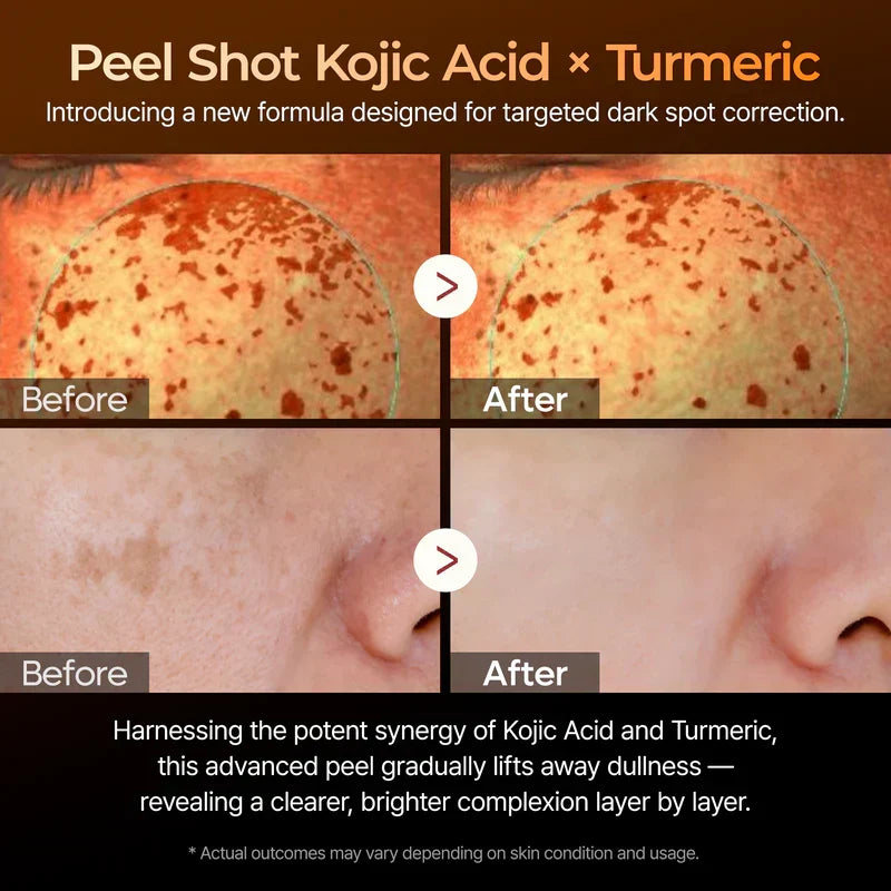 Dr Melaxin Kojic Acid Exfoliating Turmeric Spray™